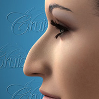 2-large-dorsal-hump-droopy-tip1