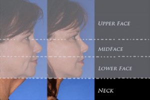 4-regions-neck1-300x200
