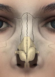 Bulbous tip - nose surgery - anatomic view