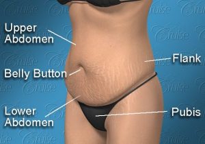 Tummy Anatomy-landscape