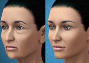 Facial Anatomy