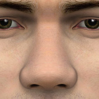 wide nasal bridge