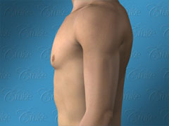 Animation of ideal male chest after gynecomastia surgery - profile view