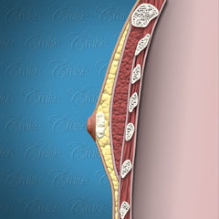 Diagram of chest tissue in ideal male chest