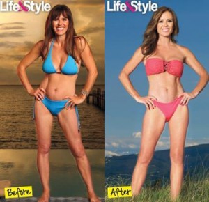breast lift before and after