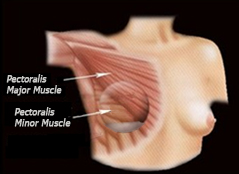 BothMuscles-Midline1