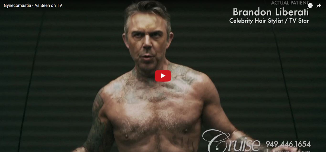 Gynecomastia is an epidemic