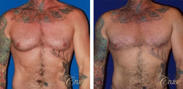 a collage of a man's chest
