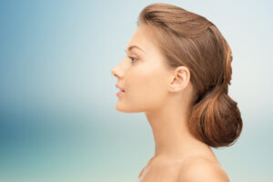 woman after rhinoplasty