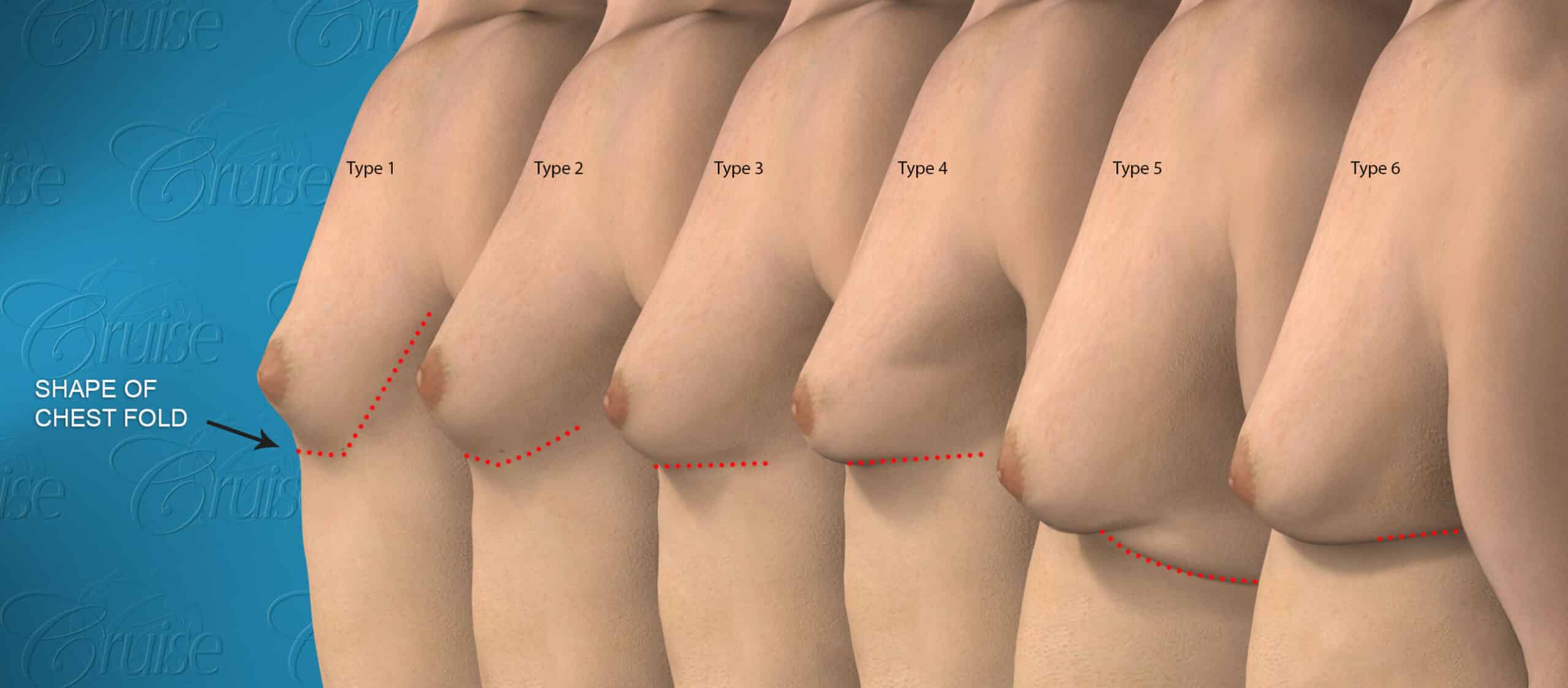 Cruise-Classification-6-Types
