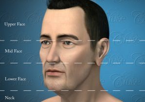 Face-Division