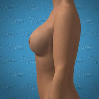 content_lat_-_high_-_over_-_solid1