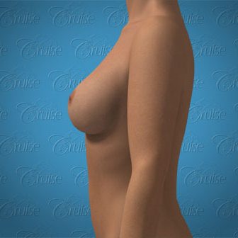 content_lat_-_low-under-solid